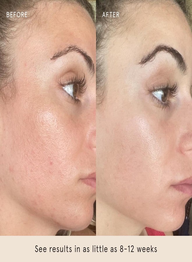 Barefaced Toning Pads (60 count) - Exfoliating Face Pads with 2% Glycolic Acid & Salicylic Acid - Brightens & Cleanses Skin, Clears Pores, Reduces Fine Lines & Wrinkles - Image 5